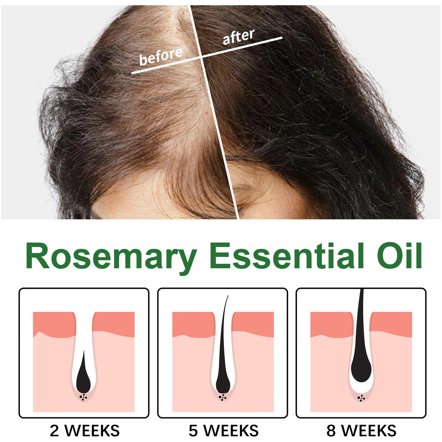Rosemary Hair Growth Oil for Postpartum Shedding & Scalp Care